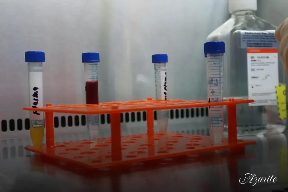 Antibiotics for fin rot: options, risks, and timing